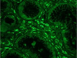 Phospho-IKK alpha/beta (Ser176, Ser180) Rabbit anti-Human, Polyclonal,