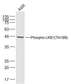 Phospho-LKB1 (Thr189) Rabbit anti-Human, Polyclonal, Bioss 100 &mu;L; Unconjugated:Antibodies,