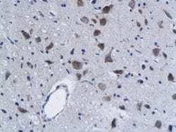 Phospho-Lyn (Tyr397) Rabbit anti-Human, Polyclonal, Bioss 100 &mu;L; Unconjugated:Antibodies,