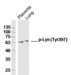 Phospho-Lyn (Tyr397) Rabbit anti-Human, Polyclonal, Bioss 100 &mu;L; Unconjugated:Antibodies,