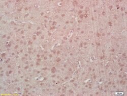 Phospho-MEF2A (Thr312) Rabbit anti-Human, Polyclonal, Bioss 100 &mu;L | Buy Online | Bioss | Fisher Scientific