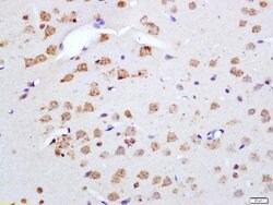 Phospho-Merlin (Ser518) Rabbit anti-Human, Polyclonal, Bioss 100 &mu;L;