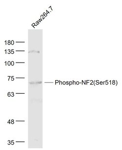 Phospho-Merlin (Ser518) Rabbit anti-Human, Polyclonal, Bioss 100 &mu;L;