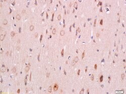 Phospho-PDK1 (Ser241) Rabbit anti-Human, Polyclonal, Bioss 100 &mu;L; Unconjugated:Antibodies,