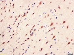 Phospho-PI3 kinase p85 alpha/gamma (Tyr467, Tyr199) Rabbit anti-Human Mouse