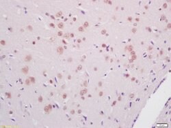 Phospho-PKR (Thr446) Rabbit anti-Human, Polyclonal, Bioss 100 &mu;L; Unconjugated:Antibodies,