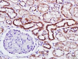 Phospho-PKR (Thr446) Rabbit anti-Human, Polyclonal, Bioss 100 &mu;L; Unconjugated:Antibodies,