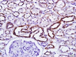 Phospho-PKR (Thr446, Thr451) Rabbit anti-Human, Polyclonal, Bioss 100 &mu;L;