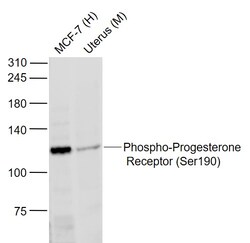 Phospho-Progesterone Receptor (Ser190) Polyclonal Antibody, Bioss 100 &mu;L | Buy Online | Bioss | Fisher Scientific