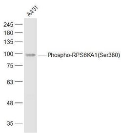 Phospho-p90RSK (Ser380) Rabbit anti-Human, Polyclonal, Bioss 100 &mu;L;
