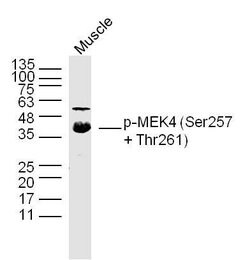Phospho-MEK4 (Ser257, Thr261) Rabbit anti-Human Mouse Rat, Polyclonal, Bioss 100 &mu;L | Buy Online | Bioss | Fisher Scientific