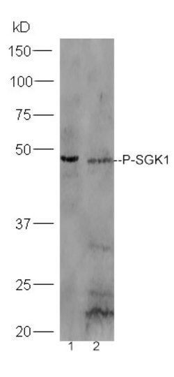 Phospho-SGK1 (Ser78) Rabbit anti-Human, Polyclonal, Bioss 100 &mu;L | Buy Online | Bioss | Fisher Scientific