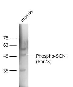 Phospho-SGK1 (Ser78) Rabbit anti-Human, Polyclonal, Bioss 100 &mu;L | Buy Online | Bioss | Fisher Scientific