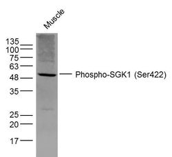 Phospho-SGK1 (Ser422) Rabbit anti-Human, Polyclonal, Bioss 100 &mu;L; Unconjugated:Antibodies,