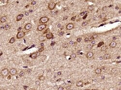 Phospho-Pyk2 (Tyr402) Rabbit anti-Human, Polyclonal, Bioss 100 &mu;L; Unconjugated:Antibodies,