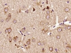 Phospho-Pyk2 (Tyr402) Rabbit anti-Human, Polyclonal, Bioss 100 &mu;L; Unconjugated:Antibodies,
