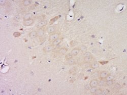 Phospho-Pyk2 (Tyr881) Rabbit anti-Human, Polyclonal, Bioss 100 &mu;L; Unconjugated:Antibodies,