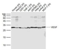 VEGF Polyclonal Antibody, Bioss 100 &mu;L; Unconjugated:Antibodies, Polyclonal