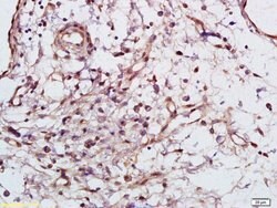 Phospho-Syk (Tyr525, Tyr526) Rabbit anti-Human Mouse Rat, Polyclonal, Bioss