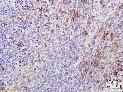 Phospho-TAK1 (Thr184, Thr187) Rabbit anti-Human Mouse Rat, Polyclonal,