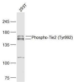 Phospho-Tie2 (Tyr992) Rabbit anti-Human, Polyclonal, Bioss 100 &mu;L | Buy Online | Bioss | Fisher Scientific