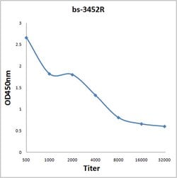 Phospho-Rb/P105 RB (Thr821) Rabbit anti-Human, Polyclonal, Bioss 100 &mu;L;