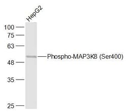 Phospho-MAP3K8 (Ser400) Rabbit anti-Human, Polyclonal, Bioss 100 &mu;L | Buy Online | Bioss | Fisher Scientific