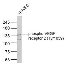 Phospho-VEGF receptor 2 (Tyr1059) Rabbit anti-Human, Polyclonal, Bioss