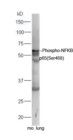 Phospho-NFKB p65 (Ser468) Rabbit anti-Human, Polyclonal, Bioss 100 &mu;L;