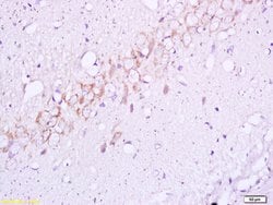 Phospho-Insulin Receptor Beta (Tyr1355) Rabbit anti-Human, Polyclonal, Bioss 100 &mu;L | Buy Online | Bioss | Fisher Scientific