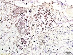 Phospho-mTOR (Ser2448) Rabbit anti-Human, Polyclonal, Bioss 100 &mu;L;