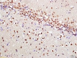 Phospho-mTOR (Ser2448) Rabbit anti-Human, Polyclonal, Bioss 100 &mu;L;