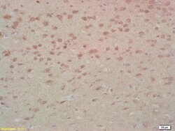 MST1 Rabbit anti-Human, Polyclonal, Bioss 100 &mu;L; Unconjugated:Antibodies,