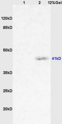 CD64/IGFR1 Rabbit anti-Human, Polyclonal, Bioss 100 &mu;L; Unconjugated:Antibodies,