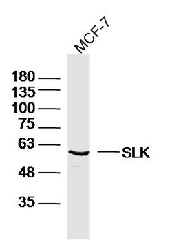 SLK Rabbit anti-Human, Polyclonal, Bioss 100 &mu;L; Unconjugated:Antibodies,