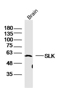 SLK Rabbit anti-Human, Polyclonal, Bioss 100 &mu;L; Unconjugated:Antibodies,