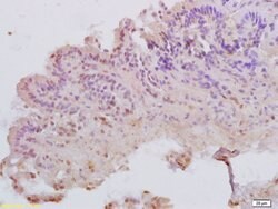 MATH1 Rabbit anti-Human, Polyclonal, Bioss 100 &mu;L; Unconjugated:Antibodies,
