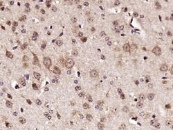 RPS6 Rabbit anti-Human, Polyclonal, Bioss 100 &mu;L; Unconjugated:Antibodies,