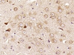 RPS6 Rabbit anti-Human, Polyclonal, Bioss 100 &mu;L; Unconjugated:Antibodies,