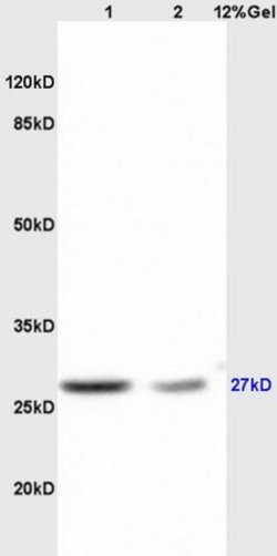 RPS6 Rabbit anti-Human, Polyclonal, Bioss 100 &mu;L; Unconjugated:Antibodies,