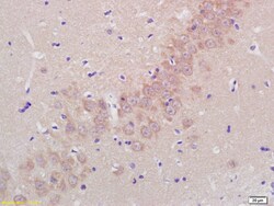 ADAMTS5 Rabbit anti-Human, Polyclonal, Bioss 100 &mu;L; Unconjugated:Antibodies,