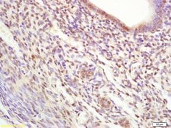 KAP1 Rabbit anti-Human, Polyclonal, Bioss 100 &mu;L; Unconjugated:Antibodies,