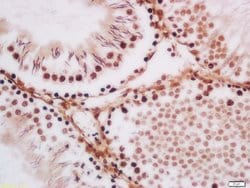 TLK1 Rabbit anti-Human, Polyclonal, Bioss 100 &mu;L | Buy Online | Bioss | Fisher Scientific