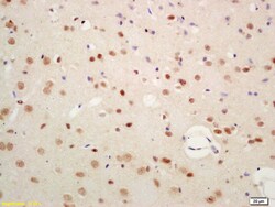 SIAH1 Rabbit anti-Human, Polyclonal, Bioss 100 &mu;L; Unconjugated:Antibodies,