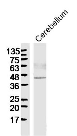 SIAH1 Rabbit anti-Human, Polyclonal, Bioss 100 &mu;L; Unconjugated:Antibodies,