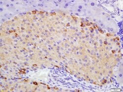 ATG1/ULK1 Rabbit anti-Human, Polyclonal, Bioss 100 &mu;L; Unconjugated:Antibodies,