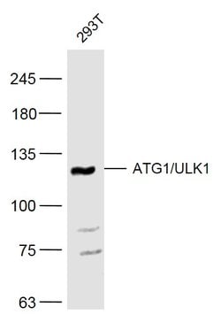 ATG1/ULK1 Rabbit anti-Human, Polyclonal, Bioss 100 &mu;L; Unconjugated:Antibodies,