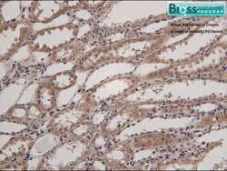 HSD11B2 Rabbit anti-Human, Polyclonal, Bioss 100 &mu;L; Unconjugated:Antibodies,
