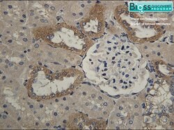 HSD11B2 Rabbit anti-Human, Polyclonal, Bioss 100 &mu;L; Unconjugated:Antibodies,