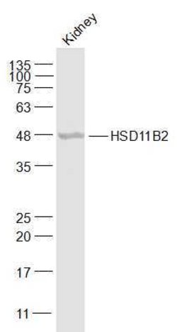 HSD11B2 Rabbit anti-Human, Polyclonal, Bioss 100 &mu;L; Unconjugated:Antibodies,